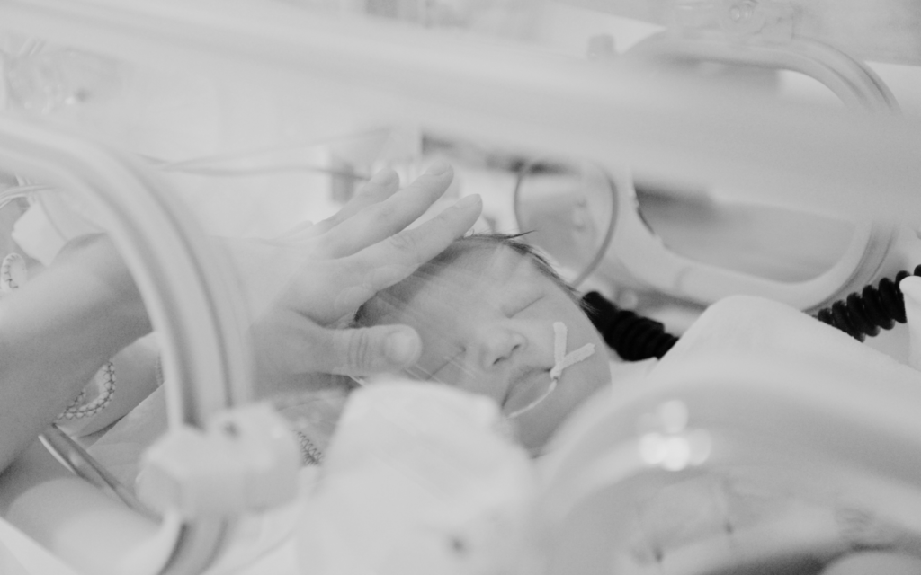 A baby in the NICU surrounded by medical equipment.