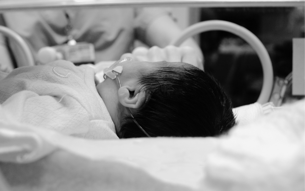 A newborn baby receiving specialized care in the NICU for a birth injury.