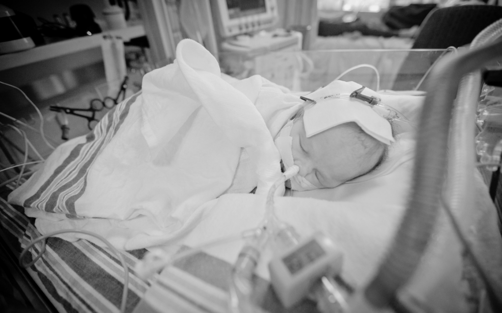 A baby resting in a hospital crib after brain surgery, with medical equipment nearby