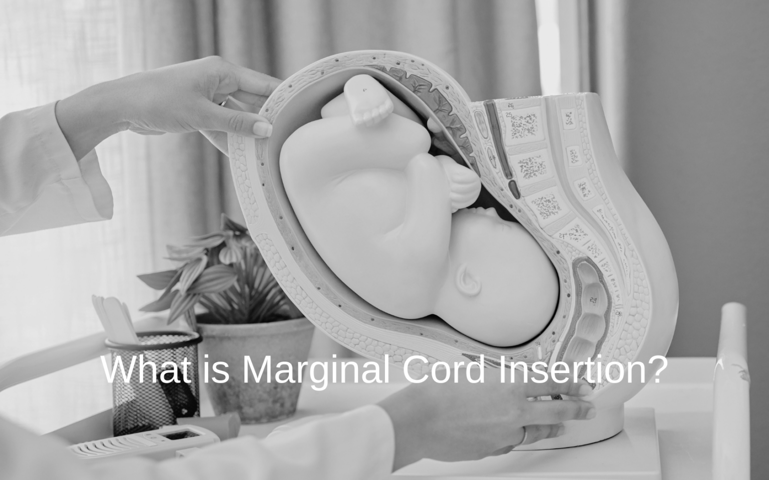 Marginal Cord Insertion Risks and Complications | Hampton & King